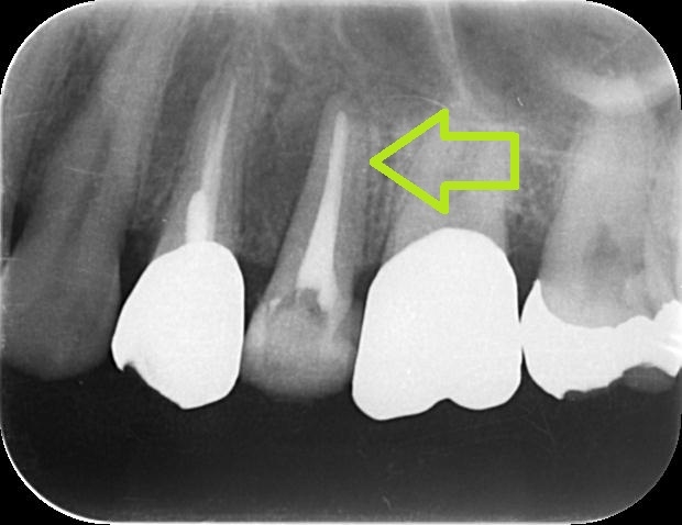 https://www.s-shika-clinic.com/asset/0000001945_111_IntraOral_20170210124522.jpg