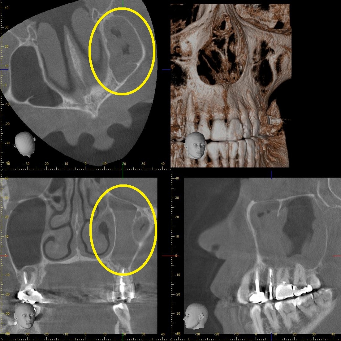 https://www.s-shika-clinic.com/asset/0000001945_222_CT_20161226180418.jpg