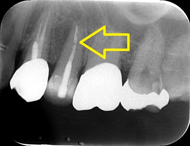 https://www.s-shika-clinic.com/asset/0000001945__IntraOral_20161226171438.jpg