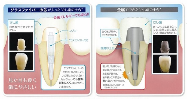 ファイバーコア