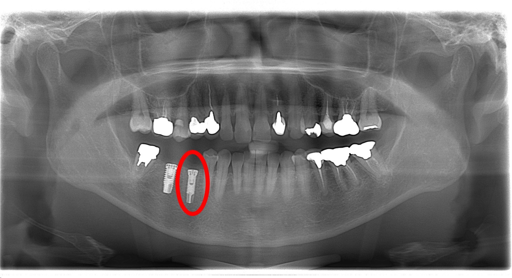 https://www.s-shika-clinic.com/asset/basshisokuji2.jpg