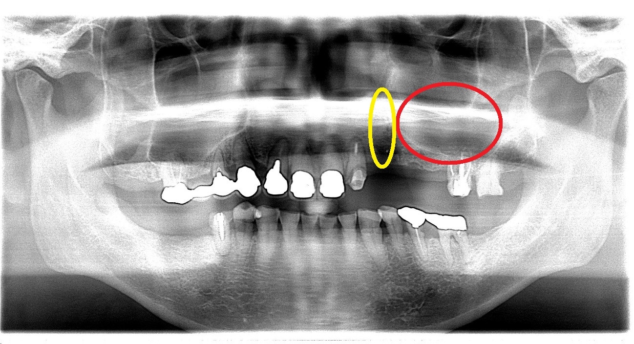 https://www.s-shika-clinic.com/asset/eea890ba0b2b5e82177638b52cc636c1b06c8020.jpg