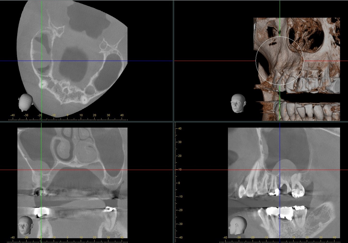 https://www.s-shika-clinic.com/asset/endo%20CT.jpg