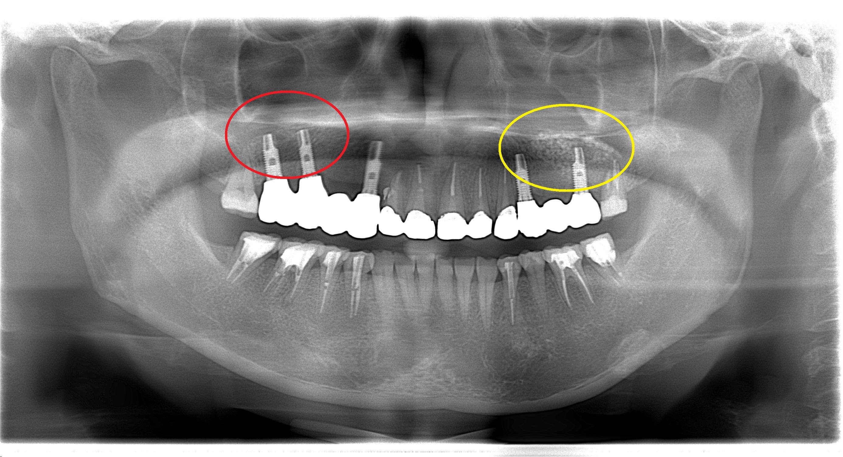 https://www.s-shika-clinic.com/asset/endo3.jpg