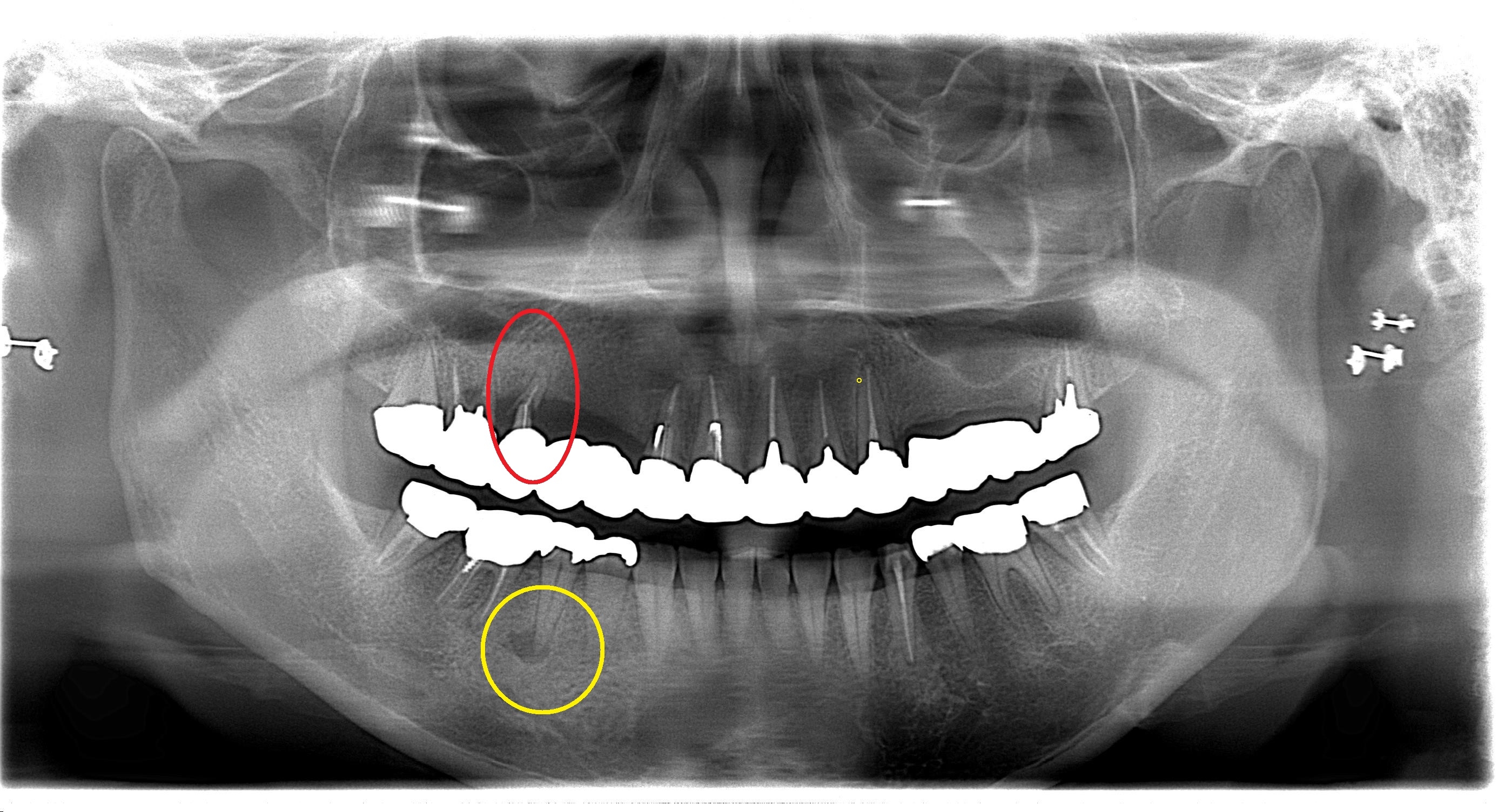 https://www.s-shika-clinic.com/asset/endo6.jpg