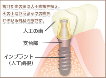 https://www.s-shika-clinic.com/asset/img54b1.jpg